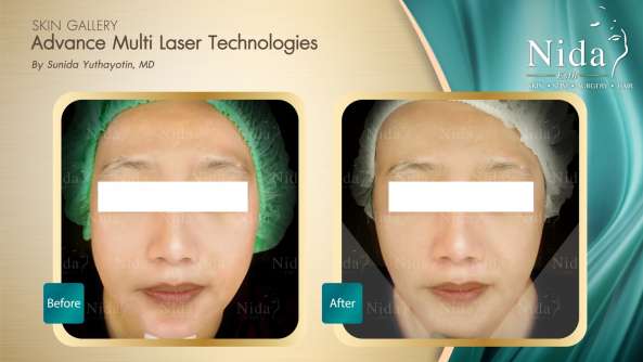 Nida Esthetic Cosmetic Surgery Bangkok