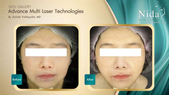 Nida Esthetic Cosmetic Surgery Bangkok