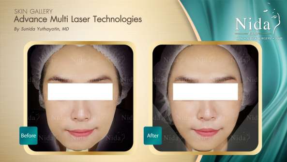 Nida Esthetic Cosmetic Surgery Bangkok