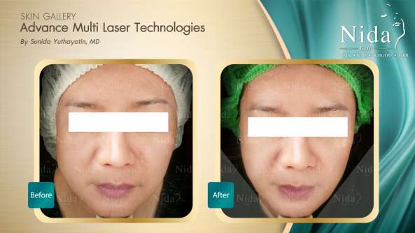 Nida Esthetic Cosmetic Surgery Bangkok