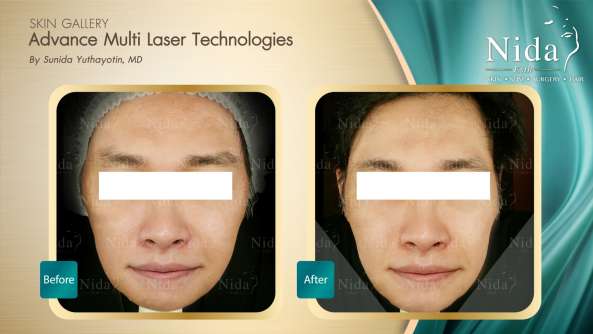 Nida Esthetic Cosmetic Surgery Bangkok