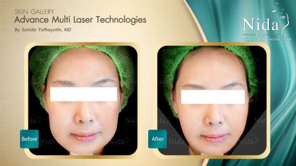 Nida Esthetic Cosmetic Surgery Bangkok