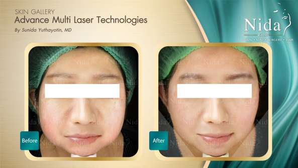 Nida Esthetic Cosmetic Surgery Bangkok