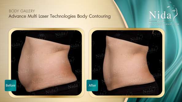 Nida Esthetic Cosmetic Surgery Bangkok