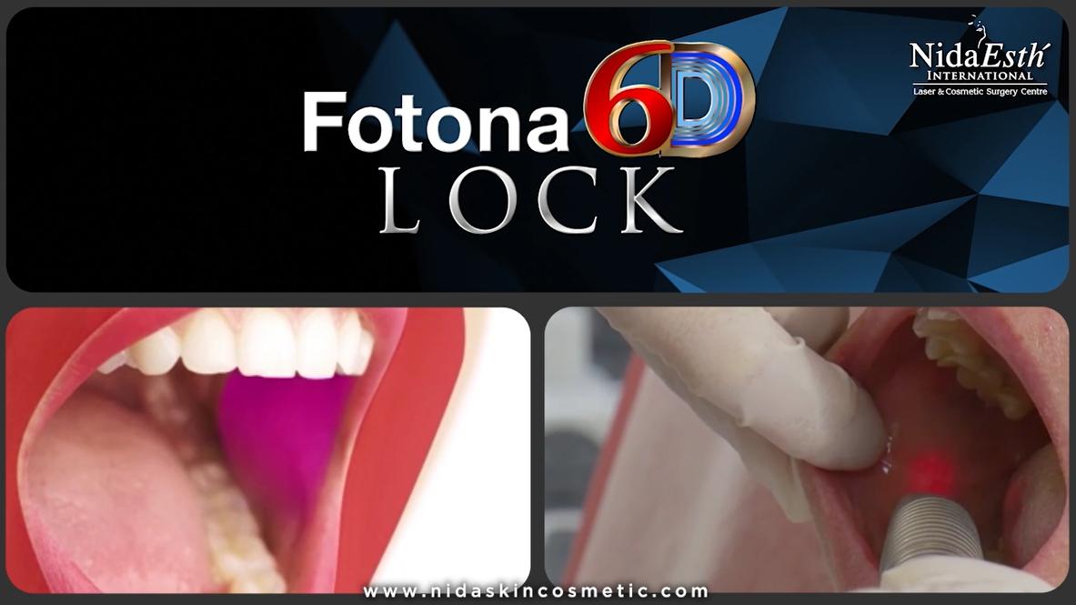 Fotona 6D