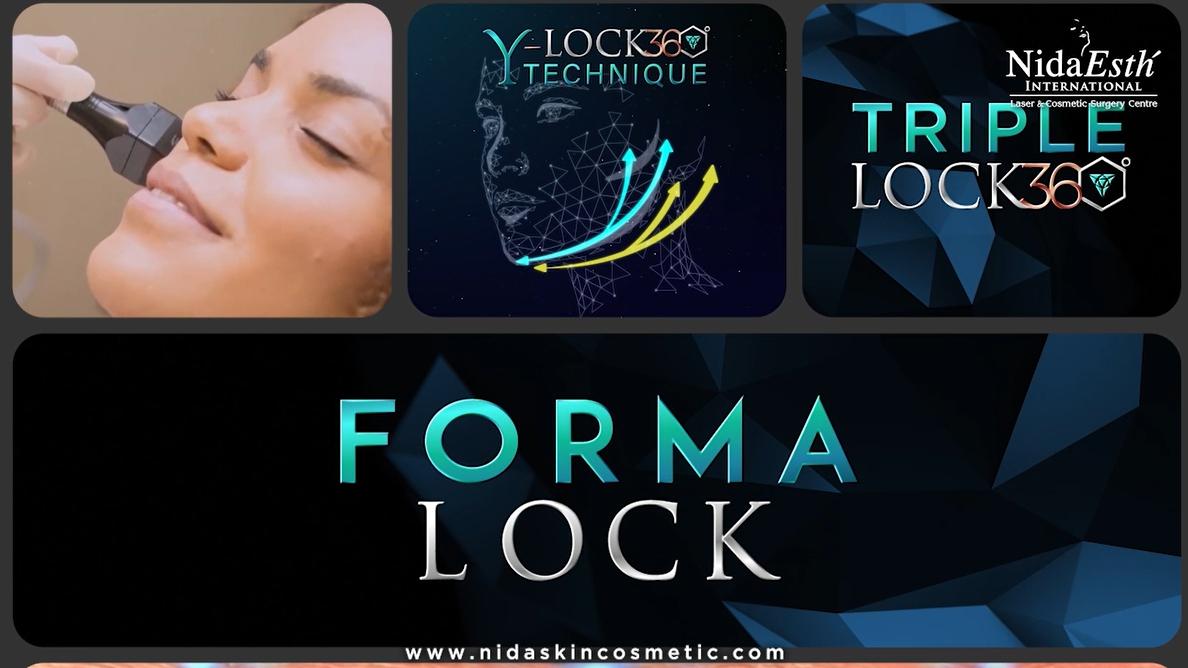 Forma Lock