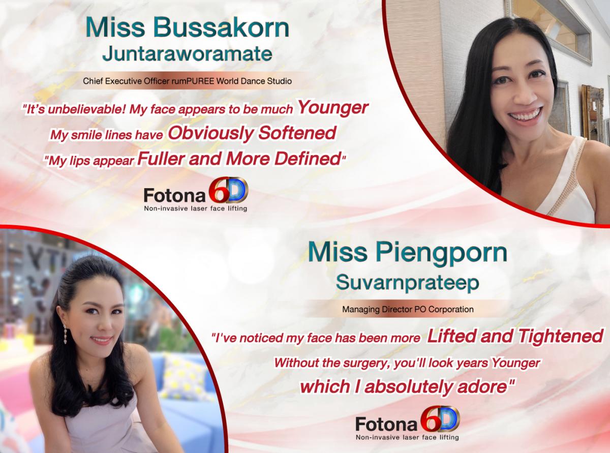 Fotona 6D Testimonial