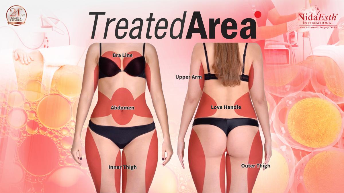 ใครเหมาะกับ tightsculpting