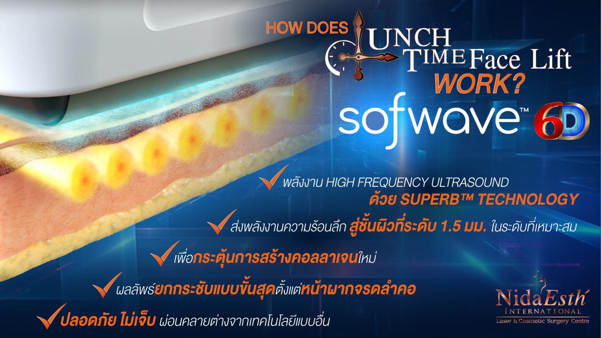 How does it work Sofwave 6D