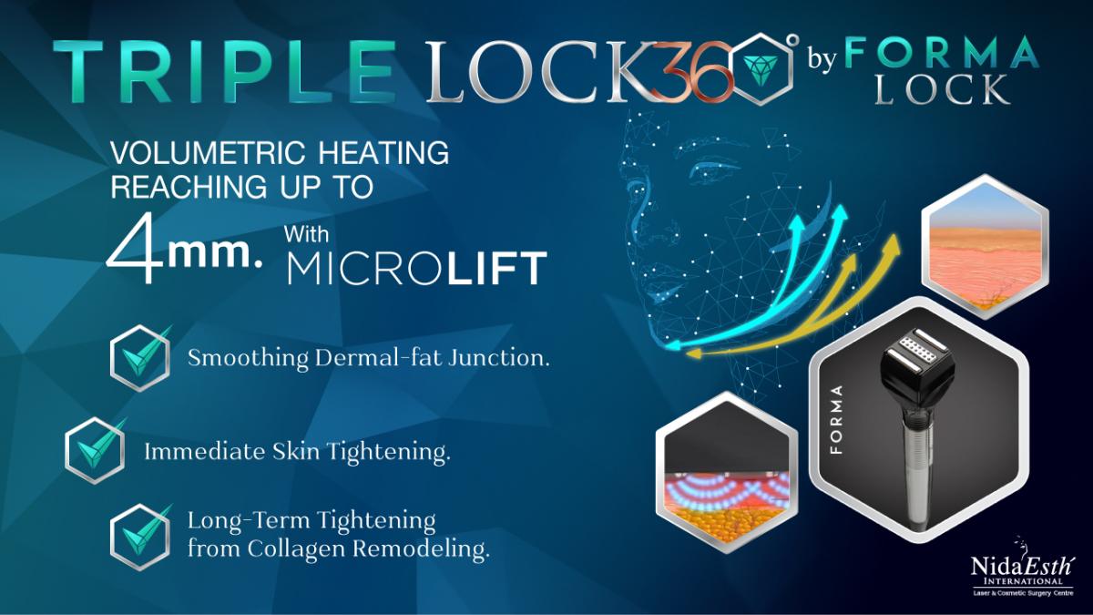 Y Lock triple lock