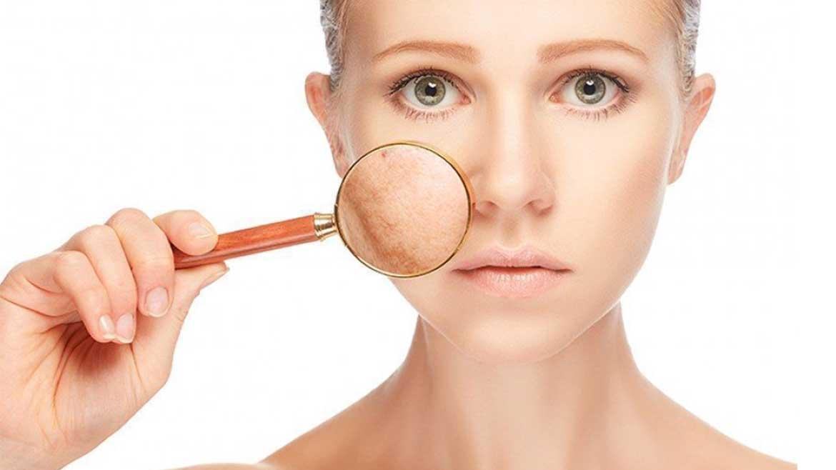 What is PicoSure 