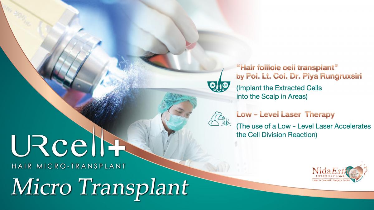 Hair Micro Transplant