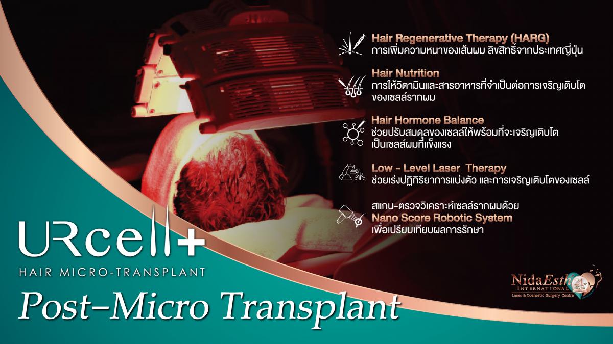 Post Hair Micro Transplant