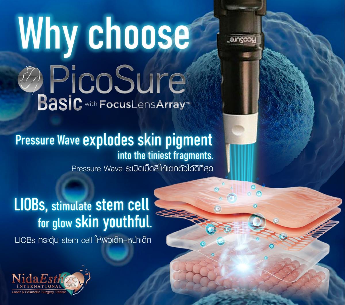 PicoSure