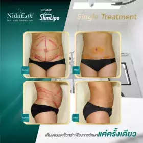 Nida Esth' ศูนยบริการทางการแพทย์ด้านความงาม แบบครบวงจร