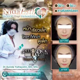 Nida Esth' ศูนยบริการทางการแพทย์ด้านความงาม แบบครบวงจร